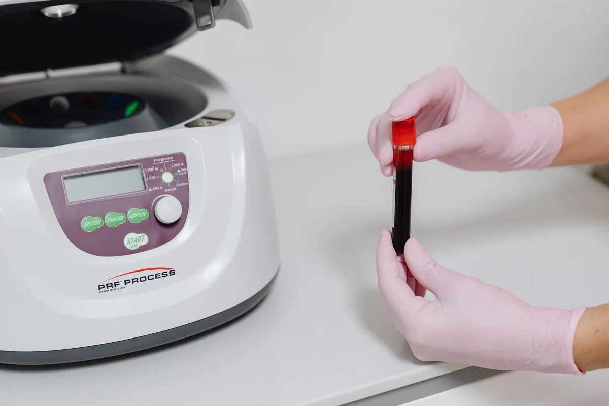 Tubo de sangue centrifugado, com o plasma separado na parte de cima, ao lado da centrífuga